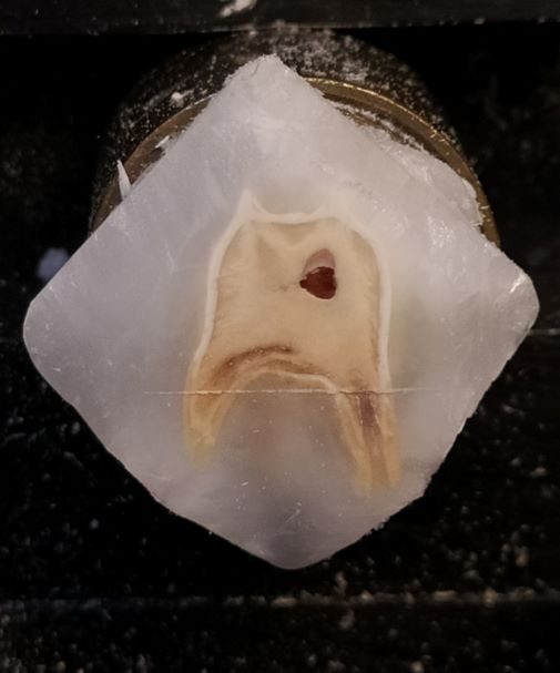 A cross section of a tooth